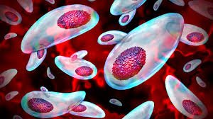 Toxoplasma