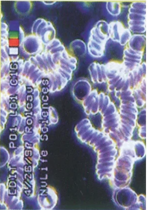 Sel Darah Merah Rantai Panjang